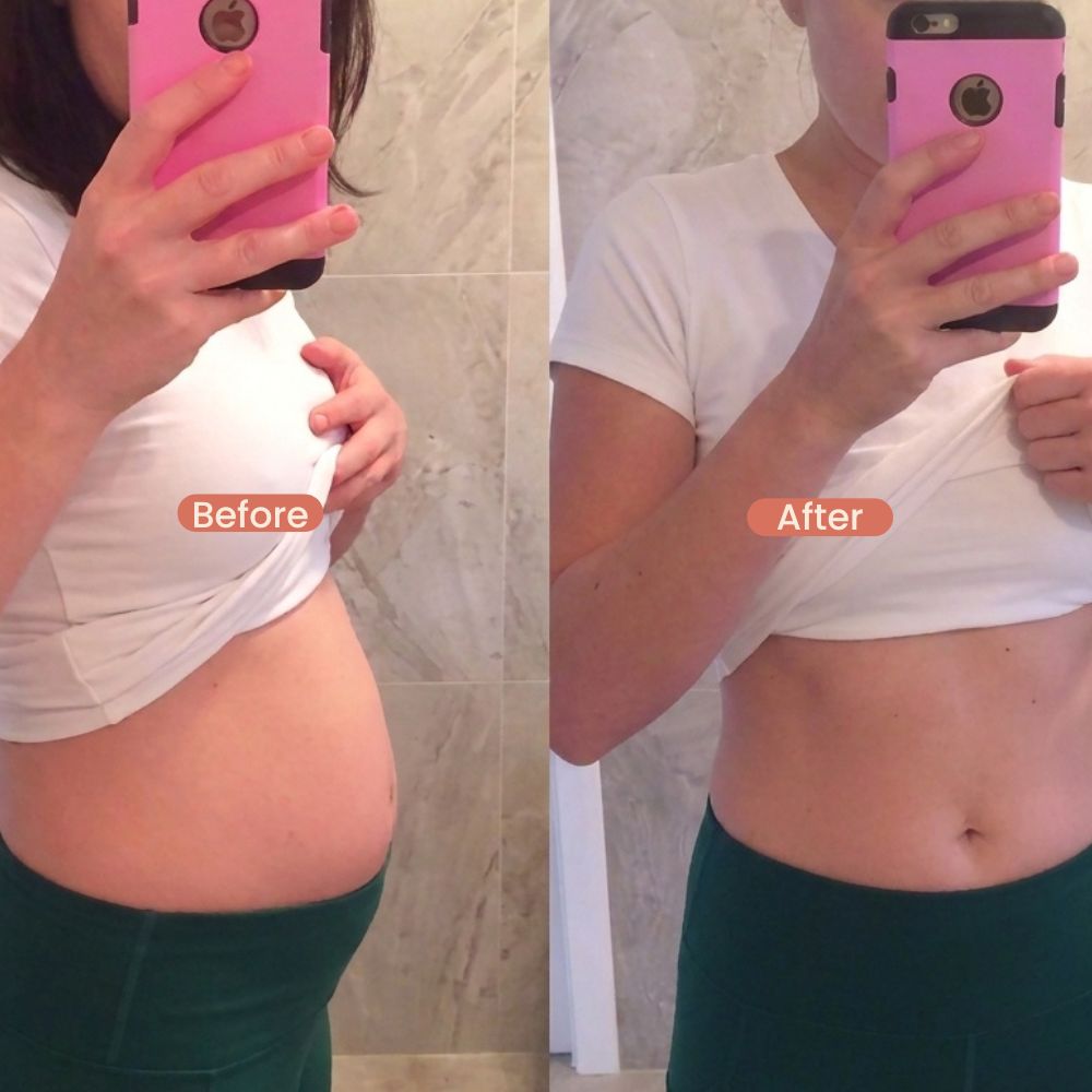 I have struggled with really severe bloating for years